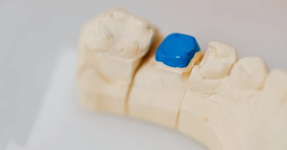 découvrez tout sur les céramiques dentaires : types, avantages, procédés de fabrication et conseils pour choisir la meilleure solution esthétique et durable pour vos soins dentaires.