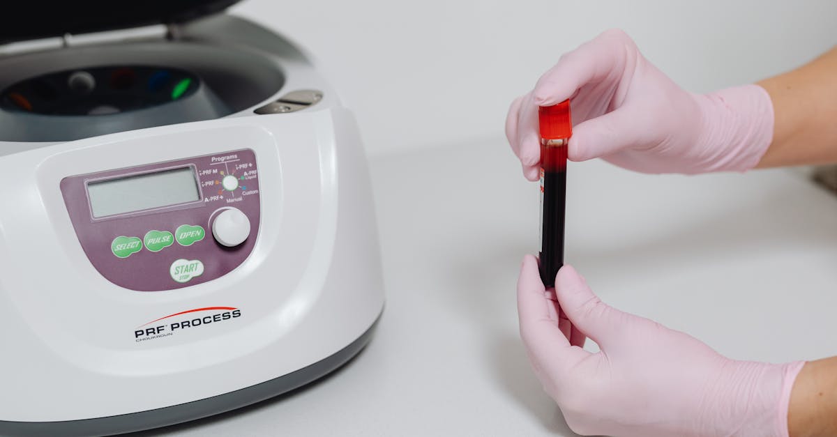 découvrez le prix du test sanguin de cortisol en france, ses modalités et où le réaliser pour surveiller votre santé hormonale efficacement.