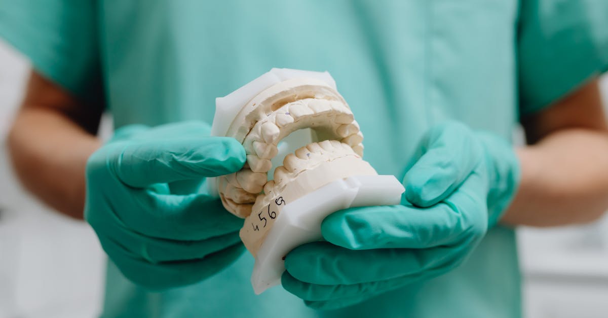 découvrez les inconvénients des inlays et onlays, y compris les limitations, les coûts et les possibles complications pour mieux choisir votre traitement dentaire.