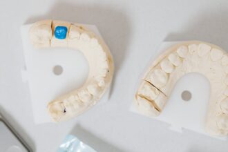 découvrez les inconvénients des inlays et onlays, avec une analyse des limites, des coûts et des éventuels effets secondaires de ces restaurations dentaires.