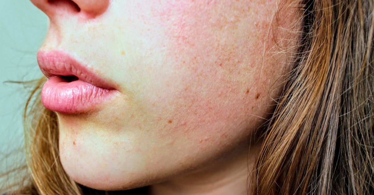 découvrez des conseils efficaces pour prendre soin de votre peau grasse, réduire la brillance et prévenir les imperfections grâce à des routines adaptées.
